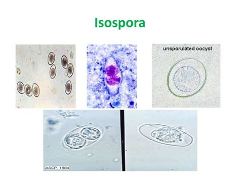  Isospora! This Tiny Parasite Can Pack Quite the Digestive Punch